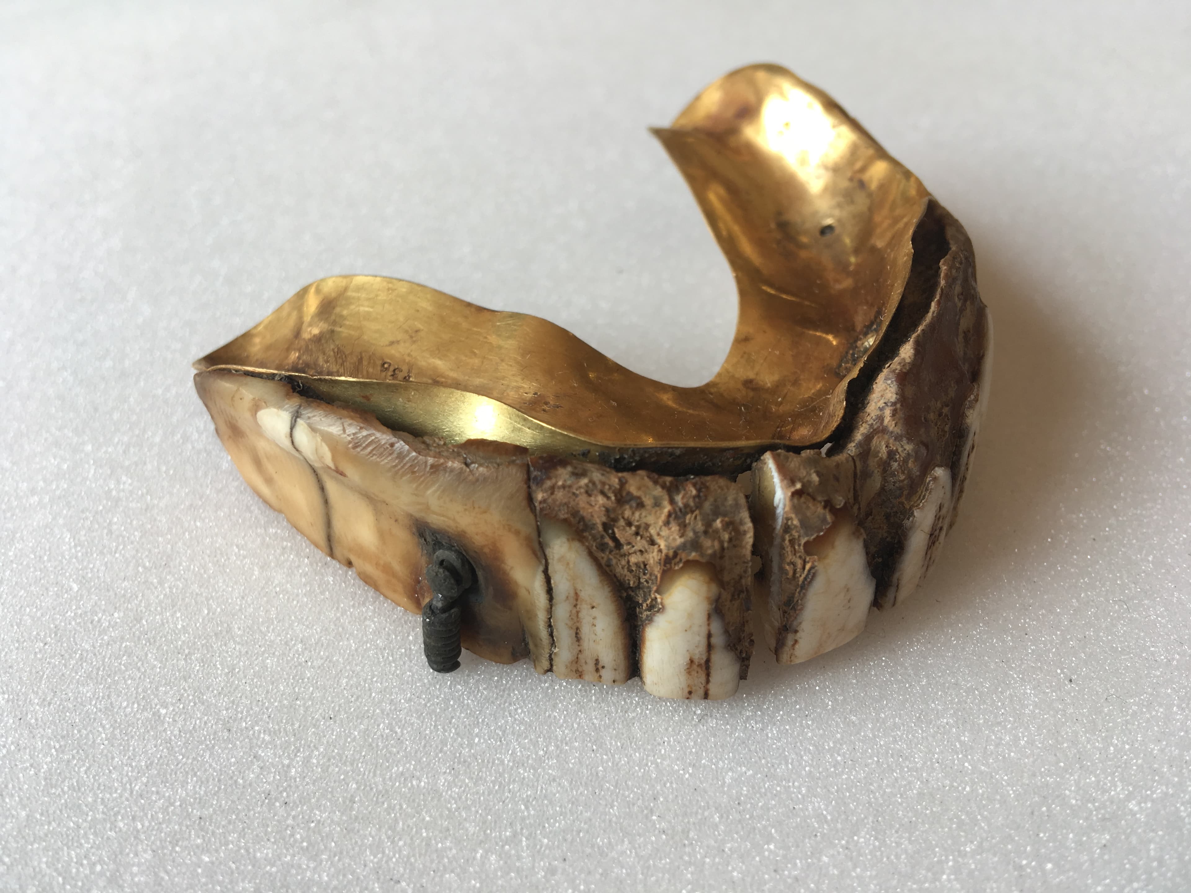 Artificial Teeth