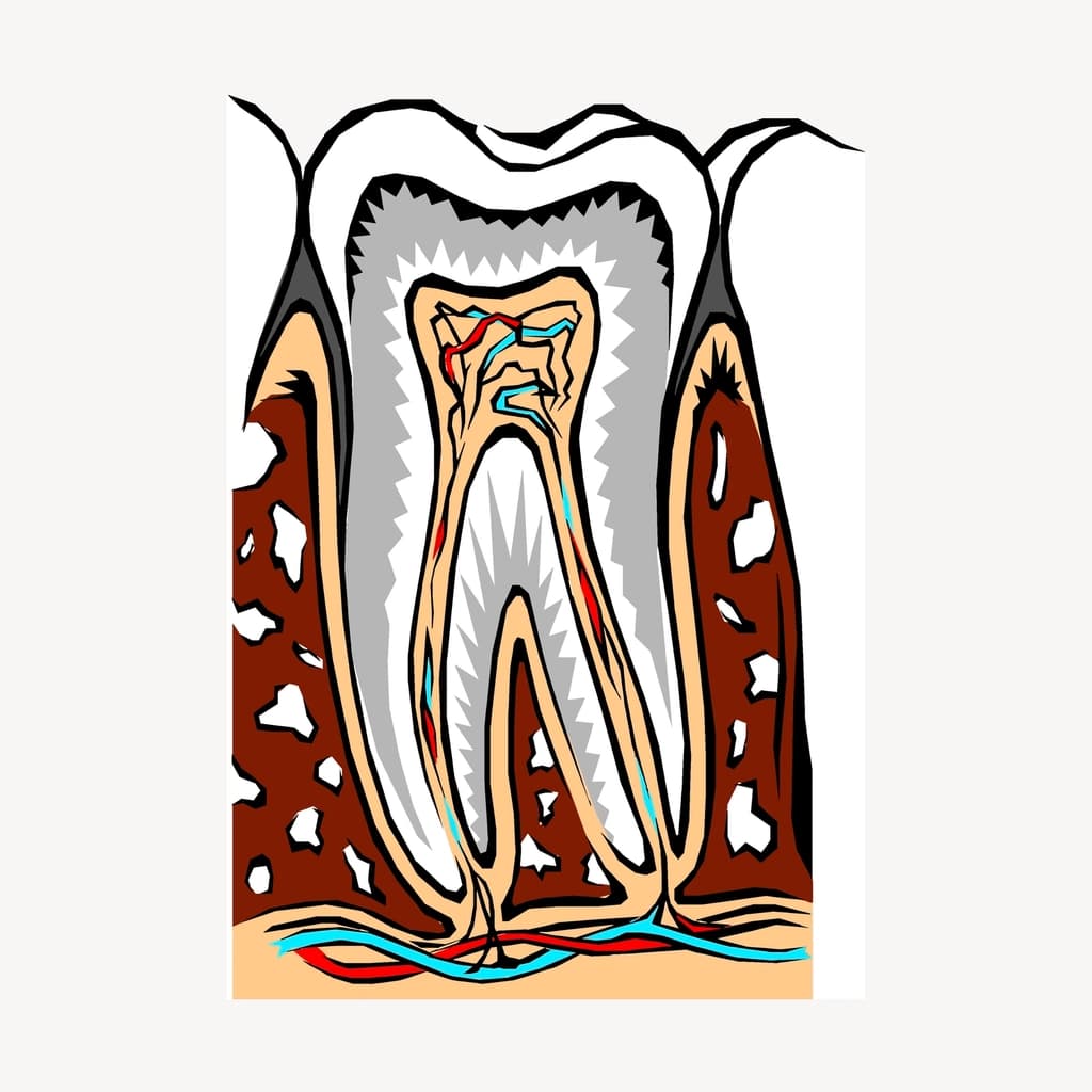 Root Canal Treatment